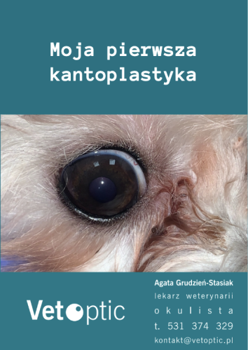 kantoplastyka.png